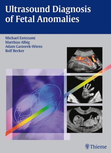 Rolf Becker, Adam Gasiorek-Wiens, Matthias Albig, Michael Entezami - Ultrasound Diagnosis of Fetal Anomalies, E-bok