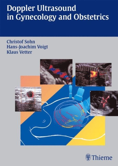 Klaus Vetter, Hans-Joachim Voigt, Christof Sohn - Doppler Ultrasound in Gynecology and Obstetrics, E-bok