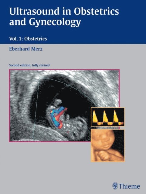 Eberhard Merz - Ultrasound in Obstetrics and Gynecology, E-bok