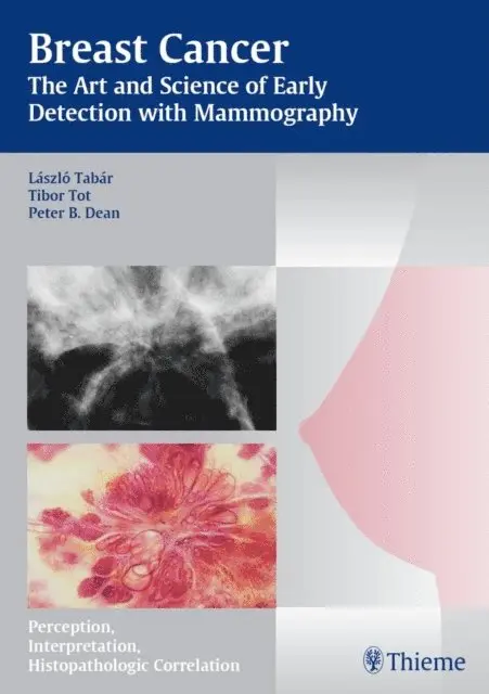 Peter B. Dean, Tibor Tot, Laszlo Tabar - Breast Cancer - The Art and Science of Early Detection with Mammography, E-bok. Tillgänglighet: Lägg i varukorg