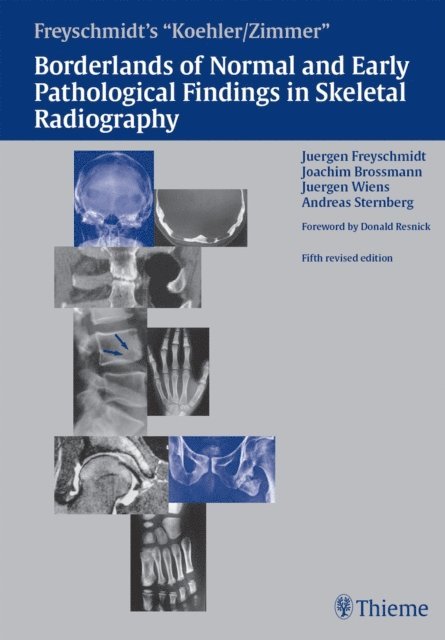 Andreas Sternberg, Jurgen Wiens, Joachim Brossmann, Jurgen Freyschmidt - Freyschmidt's &quote;Koehler/Zimmer&quote; Borderlands of Normal and Early Pathological Findings in Skeletal Radiography, E-bok