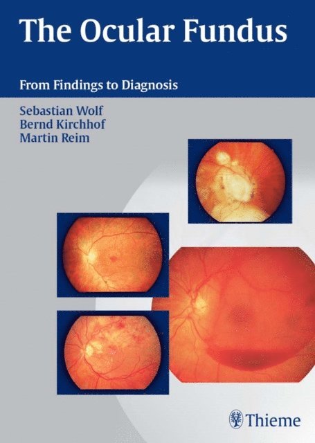 Martin Reim, Bernd Kirchhof, Sebastian Wolf - Ocular Fundus, E-bok