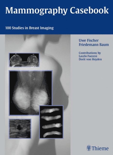 Uwe Fischer - Mammography Casebook, E-bok