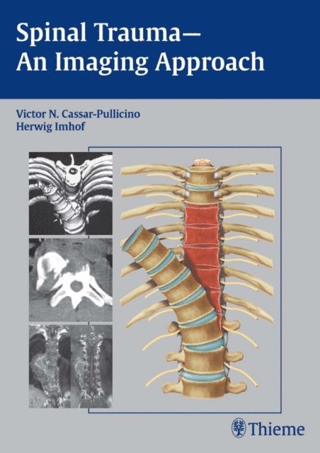 Herwig Imhof, Victor N. Cassar-Pullicino - Spinal Trauma - An Imaging Approach, E-bok