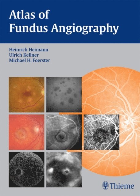Michael H. Foerster, Ulrich Kellner, Heinrich Heimann - Atlas of Fundus Angiography, E-bok