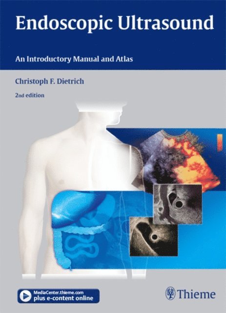Christoph Frank Dietrich - Endoscopic Ultrasound, E-bok