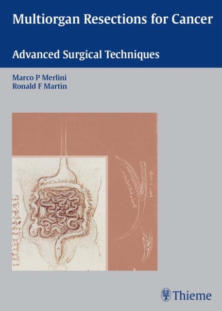 Ronald F. Martin, Marco Merlini - Multiorgan Resections for Cancer, E-bok. Tillgänglighet: Lägg i varukorg