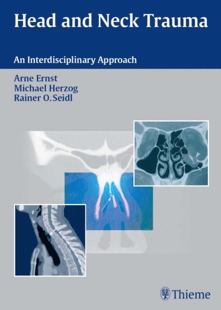 Rainer Ottis Seidl, Michael Herzog, Arneborg Ernst - Head and Neck Trauma, E-bok