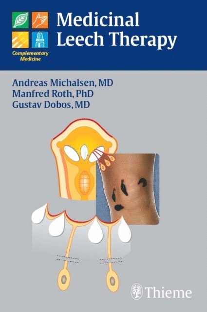 Gustav Dobos, Manfred Roth, Andreas Michalsen - Medicinal Leech Therapy, E-bok