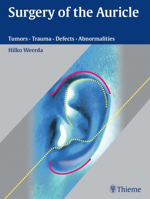 Hilko Weerda - Surgery of the Auricle, E-bok