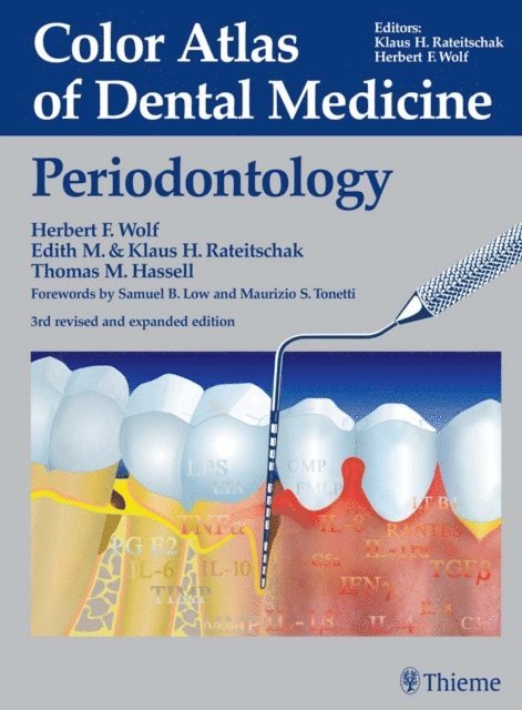 Thomas M. Hassell, Klaus H. Rateitschak, Edith M. Rateitschak-Pluss, Herbert F. Wolf - Color Atlas of Dental Medicine: Periodontology, E-bok