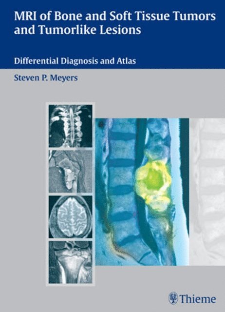Steven Meyers - MRI of Bone and Soft Tissue Tumors and Tumorlike Lesions, E-bok