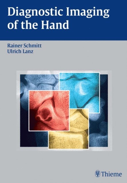 Ulrich Lanz, Rainer Schmitt - Diagnostic Imaging of the Hand, E-bok
