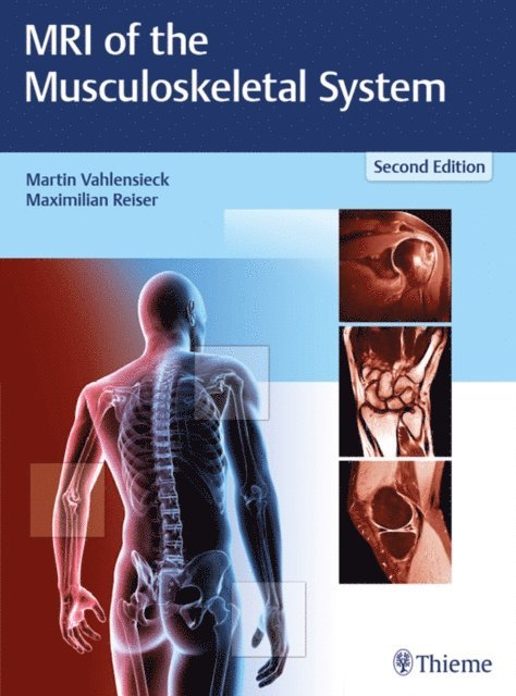 Maximilian Reiser, Martin Vahlensieck - MRI of the Musculoskeletal System, E-bok