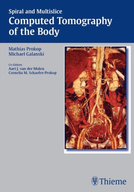 Michael Galanski, Mathias Prokop - Spiral and Multislice Computed Tomography of the Body, E-bok