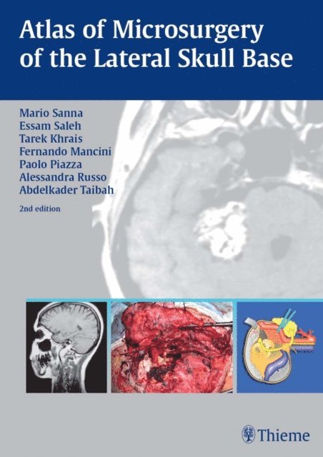 Abdelkader Taibah, Alessandra Russo, Paolo Piazza, Essam A. Saleh, Fernando Mancini, Tarek Khrais, Mario Sanna - Atlas of Microsurgery of the Lateral Skull Base, E-bok