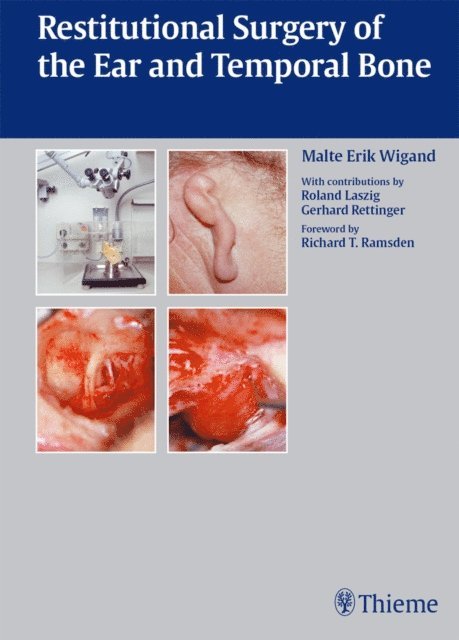 Gerhard Rettinger, Roland Laszig, Malte Erik Wigand - Restitutional Surgery of the Ear and Temporal Bone, E-bok