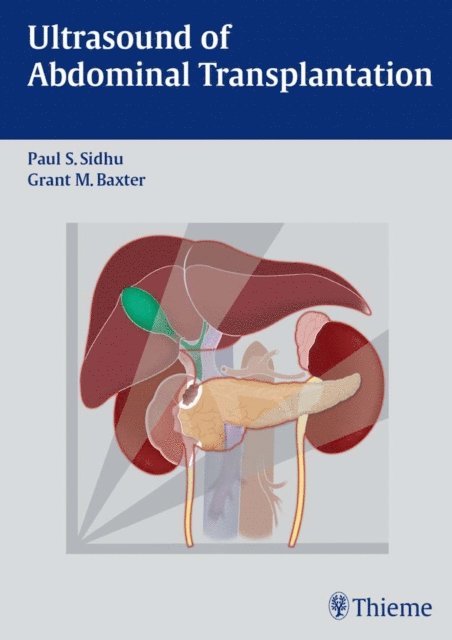 Grant M. Baxter, Paul S. Sidhu - Ultrasound of Abdominal Transplantation, E-bok