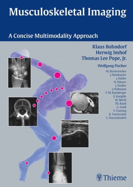 Thomas Lee Pope, Herwig Imhof, Klaus Bohndorf - Musculoskeletal Imaging, E-bok