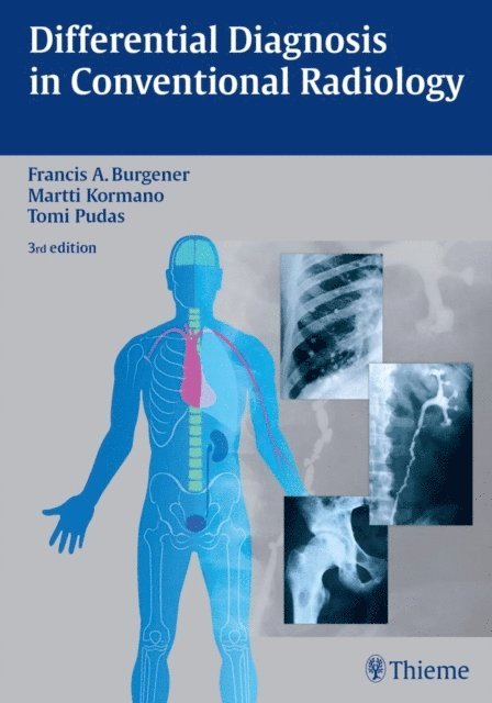 Tomi Pudas, Martti Kormano, Francis A. Burgener - Differential Diagnosis in Conventional Radiology, E-bok