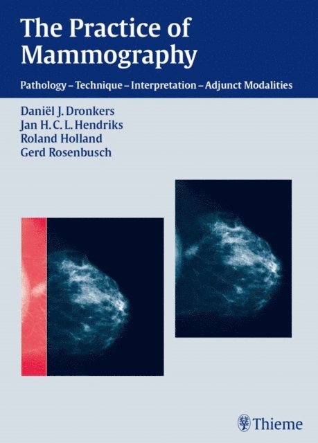 Gerd Rosenbusch, Roland Holland, Jan H.C.L. Hendriks, Daniel J. Dronkers - Practice of Mammography, E-bok. Tillgänglighet: Lägg i varukorg