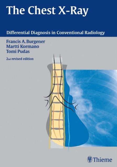 Tomi Pudas, Martti Kormano, Francis A. Burgener - Chest X-Ray, E-bok