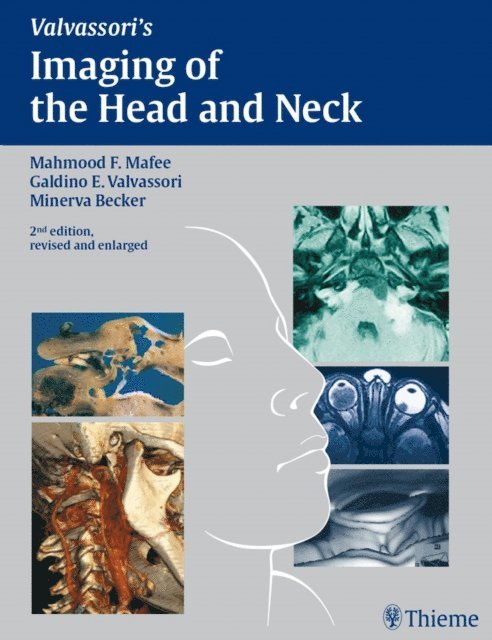 Minerva Becker, Galdino E. Valvassori, Mahmood F. Mafee - Imaging of the Head and Neck, E-bok