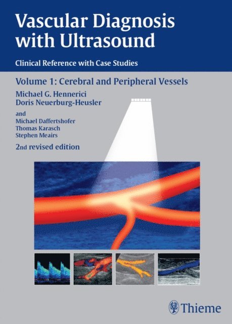 Doris Neuerburg-Heusler, Michael G. Hennerici - Vascular Diagnosis with Ultrasound, E-bok
