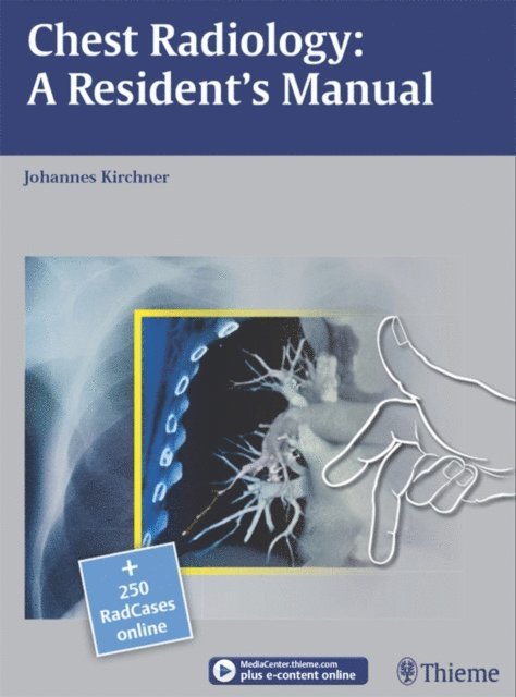 Johannes Kirchner - Chest Radiology: A Resident's Manual, E-bok