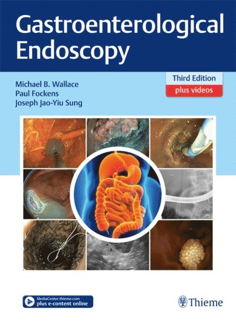 Joseph Jao-Yiu Sung, Paul Fockens, Michael B. Wallace - Gastroenterological Endoscopy, E-bok