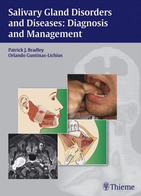 Orlando Guntinas-Lichius, Patrick J. Bradley - Salivary Gland Disorders and Diseases, E-bok