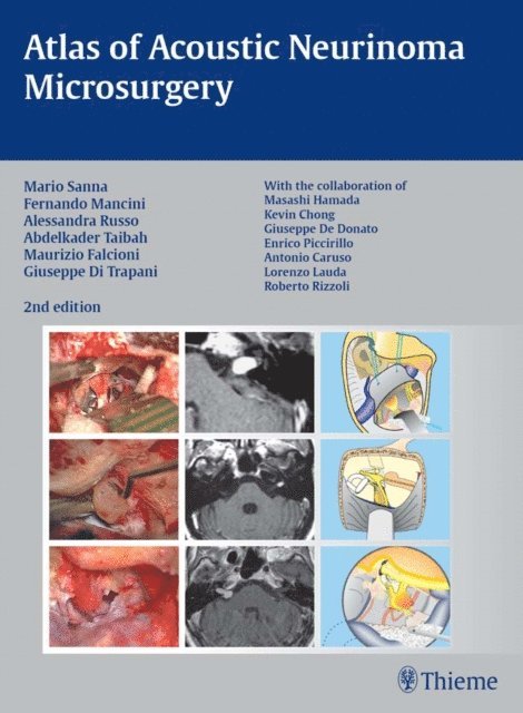 Giuseppe Di Trapani, Maurizio Falcioni, Abdelkader Taibah, Alessandra Russo, Fernando Mancini, Mario Sanna - Atlas of Acoustic Neurinoma Microsurgery, E-bok