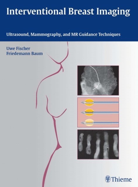 Friedemann Baum, Uwe Fischer - Interventional Breast Imaging, E-bok