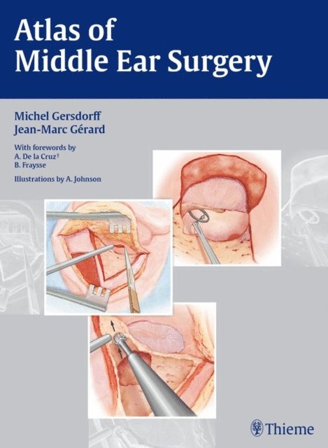 Jean-Marc Gerard, Michel Gersdorff - Atlas of Middle Ear Surgery, E-bok