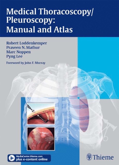 Pyng Lee, Marc Noppen, Praveen N. Mathur, Robert Loddenkemper - Medical Thoracoscopy / Pleuroscopy: Manual and Atlas, E-bok