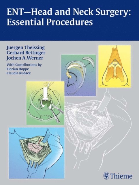 Jochen A. Werner, Gerhard Rettinger, Juergen Theissing - ENT-Head and Neck Surgery: Essential Procedures, E-bok