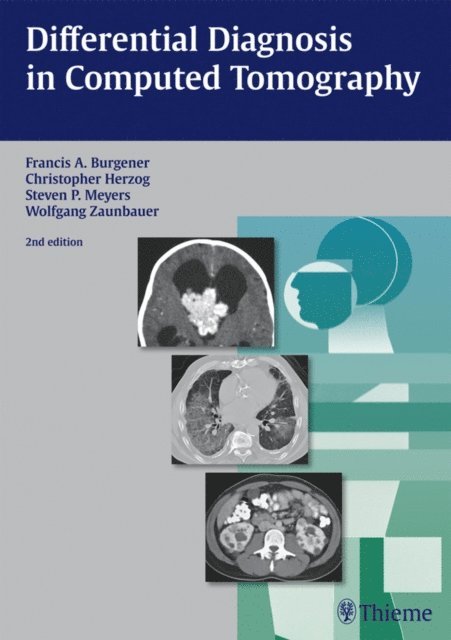 Wolfgang Zaunbauer, Steven Meyers, Christopher Herzog, Francis A. Burgener - Differential Diagnosis in Computed Tomography, E-bok