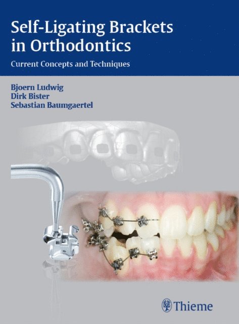 Sebastian Baumgaertel, Dirk Bister, Bjorn Ludwig - Self-Ligating Brackets in Orthodontics, E-bok