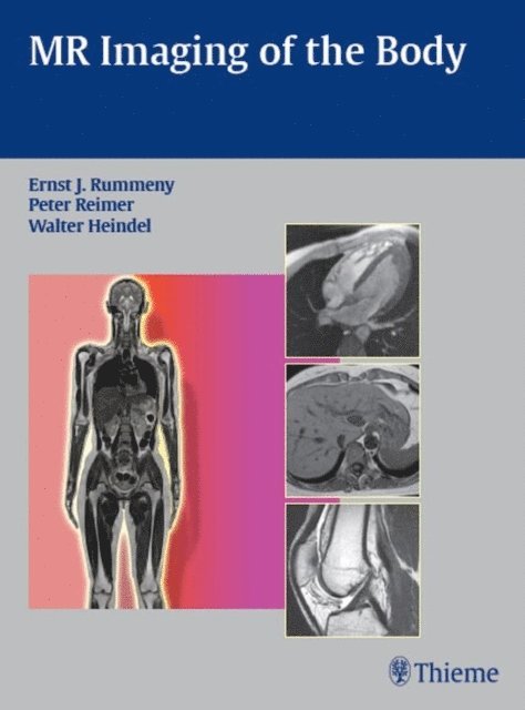 Walter Heindel, Peter Reimer, Ernst Rummeny - MR Imaging of the Body, E-bok