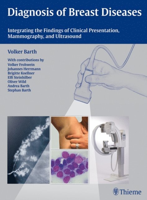 Volker Barth - Diagnosis of Breast Diseases, E-bok