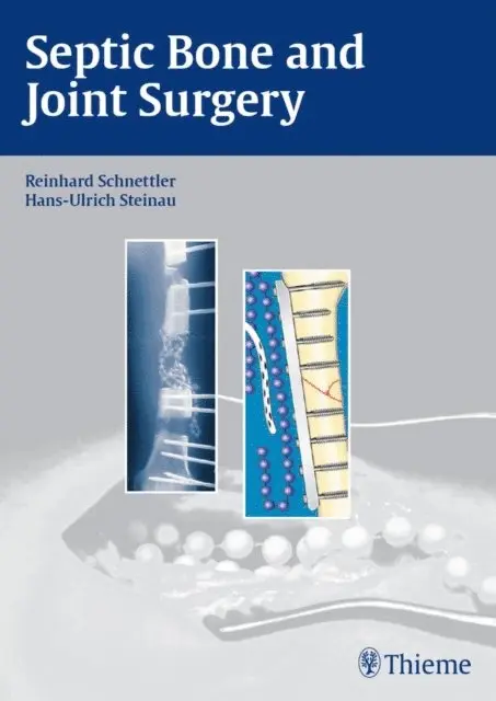 Hans-Ulrich Steinau, Reinhard Schnettler - Septic Bone and Joint Surgery, E-bok. Tillgänglighet: Lägg i varukorg