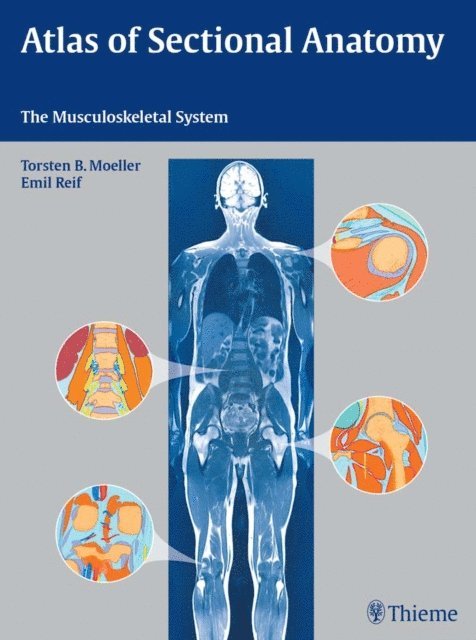 Emil Reif, Torsten Bert Moller - Atlas of Sectional Anatomy, E-bok