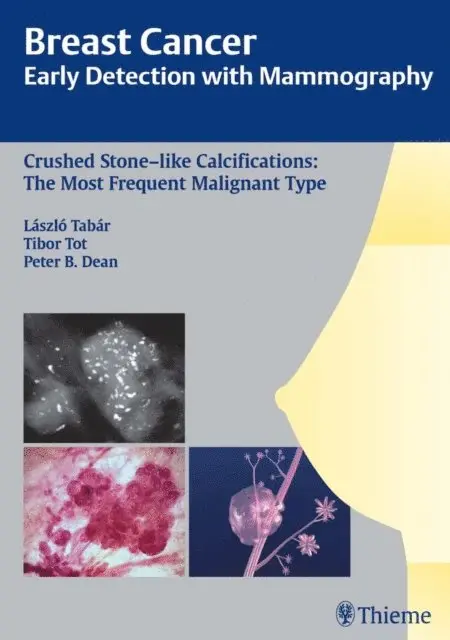 Peter B. Dean, Tibor Tot, Laszlo Tabar - Breast Cancer: Early Detection with Mammography, E-bok. Tillgänglighet: Lägg i varukorg