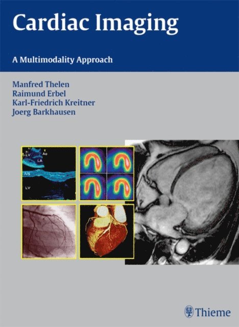 Jorg Barkhausen, Karl-Friedrich Kreitner, Raimund Erbel, Manfred Thelen - Cardiac Imaging, E-bok