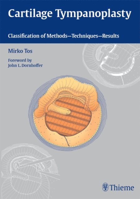 Mirko Tos - Cartilage Tympanoplasty, E-bok. Tillgänglighet: Lägg i varukorg