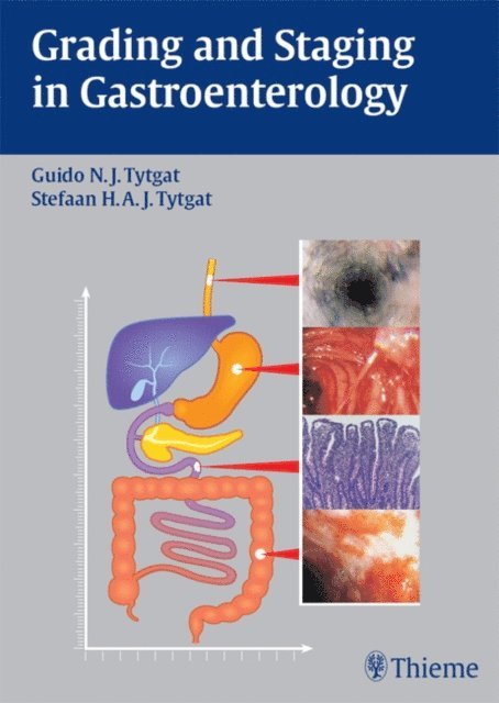 Stefaan H.A.J. Tytgat, Guido N. J. Tytgat - Grading and Staging in Gastroenterology, E-bok