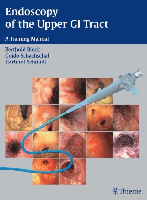 Hartmut H.-J. Schmidt, Guido Schachschal, Berthold Block - Endoscopy of the Upper GI Tract, E-bok. Tillgänglighet: Lägg i varukorg