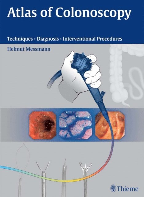 Helmut Messmann - Atlas of Colonoscopy, E-bok