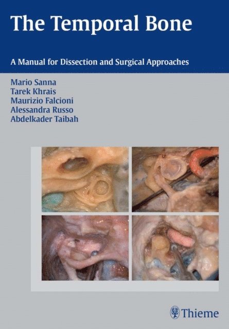 Abdelkader Taibah, Alessandra Russo, Maurizio Falcioni, Tarek Khrais, Mario Sanna - Temporal Bone, E-bok