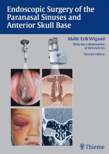 Malte Erik Wigand - Endoscopic Surgery of the Paranasal Sinuses and Anterior Skull Base, E-bok
